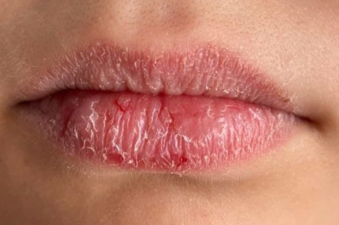 El bálsamo sin fin: cuando los labios piden algo más que cera