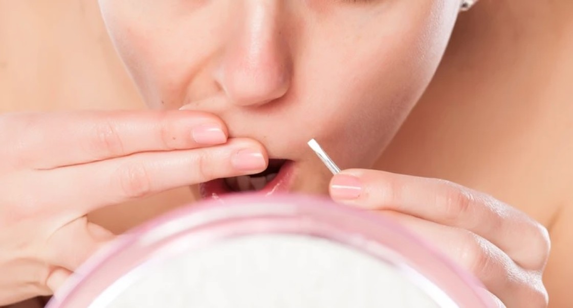 Cuando dos pelitos no son solo dos pelitos