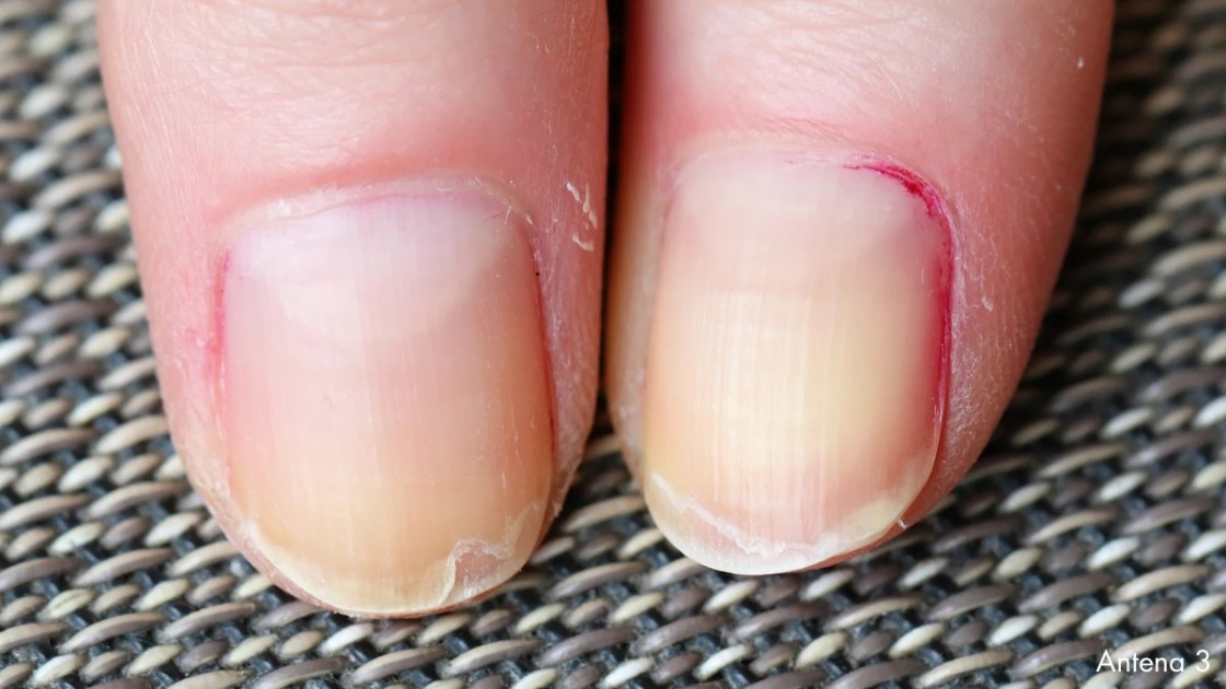 Cuando las uñas hablan