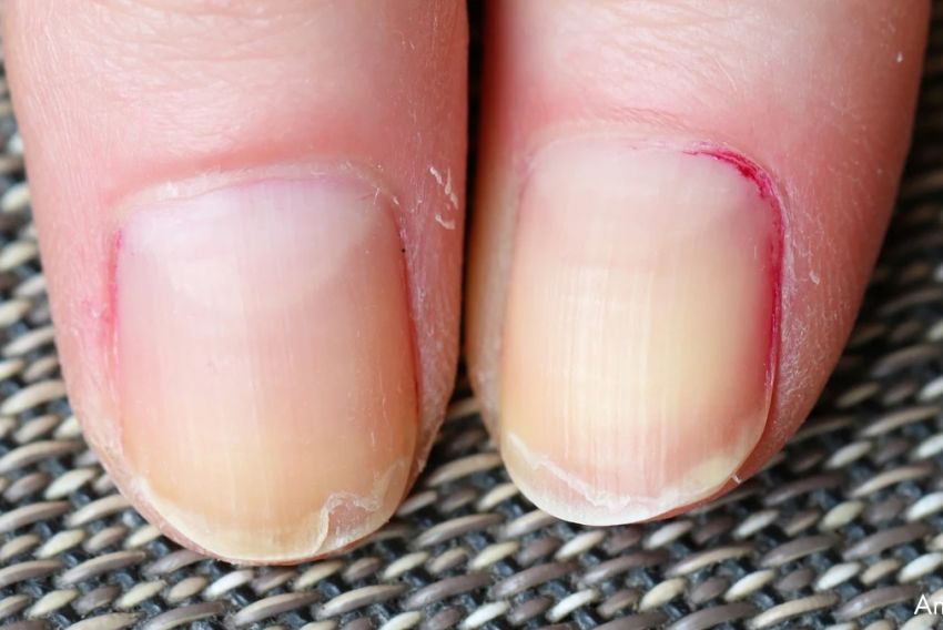 Cuando las uñas hablan