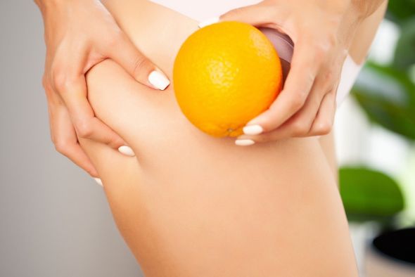 Celulitis: la piel de naranja que no es una enfermedad