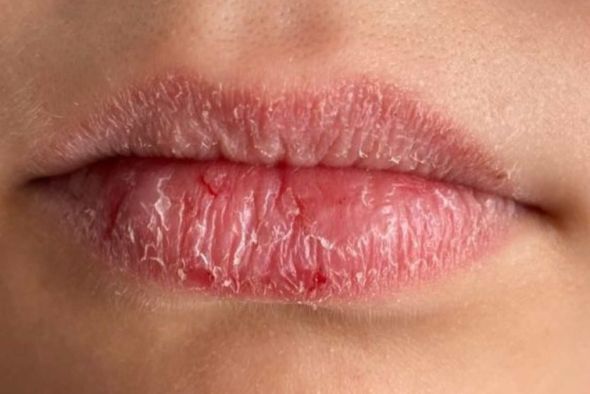 El bálsamo sin fin: cuando los labios piden algo más que cera