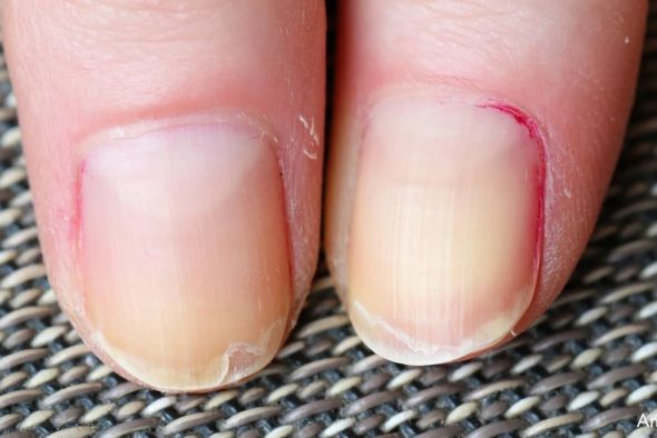 Cuando las uñas hablan