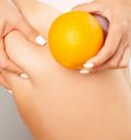 Celulitis: la piel de naranja que no es una enfermedad