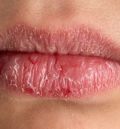 El bálsamo sin fin: cuando los labios piden algo más que cera